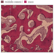 Istologia della biopsia di un seno