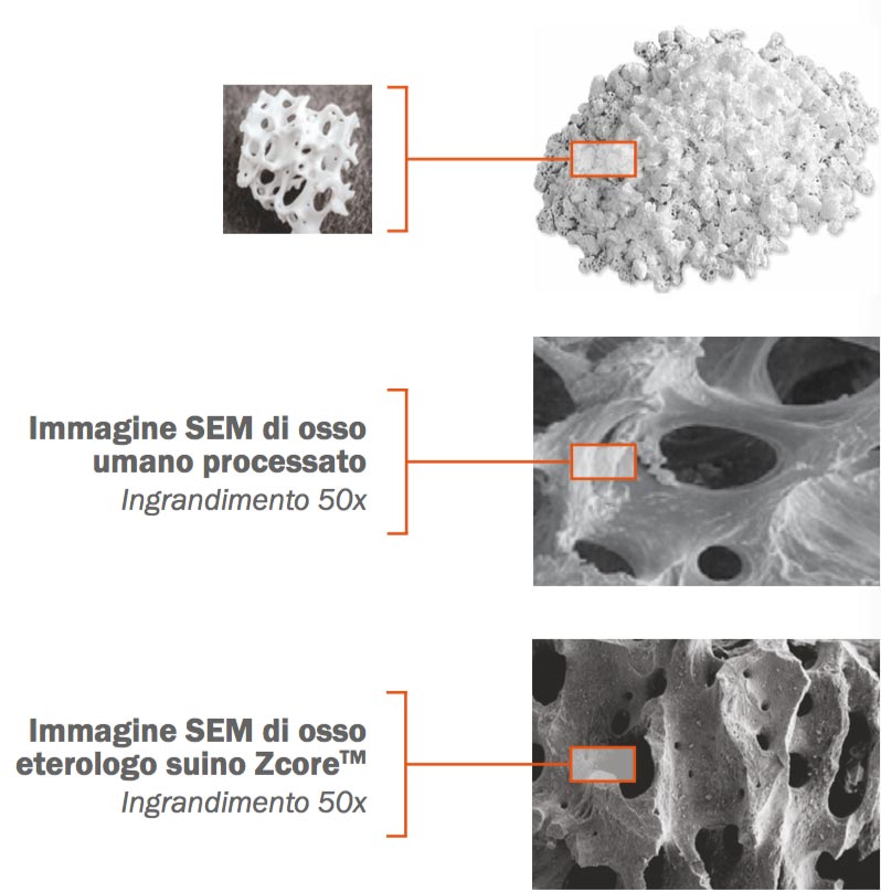 zcore-sem