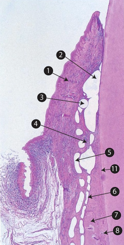 ist1-matrix-barrier