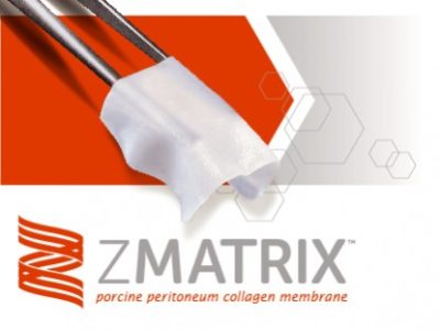 zmatrix download