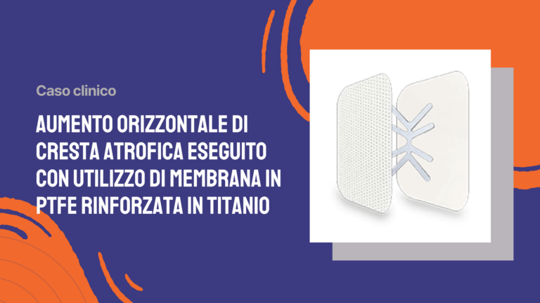 Aumento orizzontale di cresta atrofica eseguito con utilizzo di membrana in PTFE rinforzata in titanio