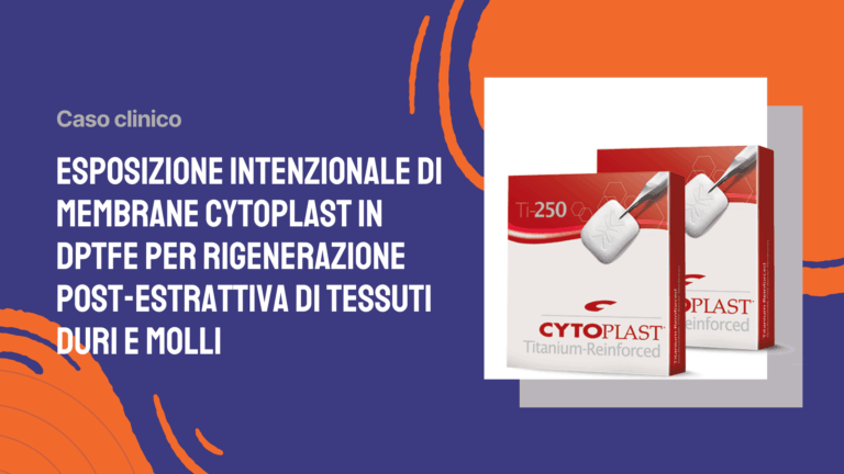 Esposizione intenzionale di membrane Cytoplast in dPTFE per rigenerazione post-estrattiva di tessuti duri e molli