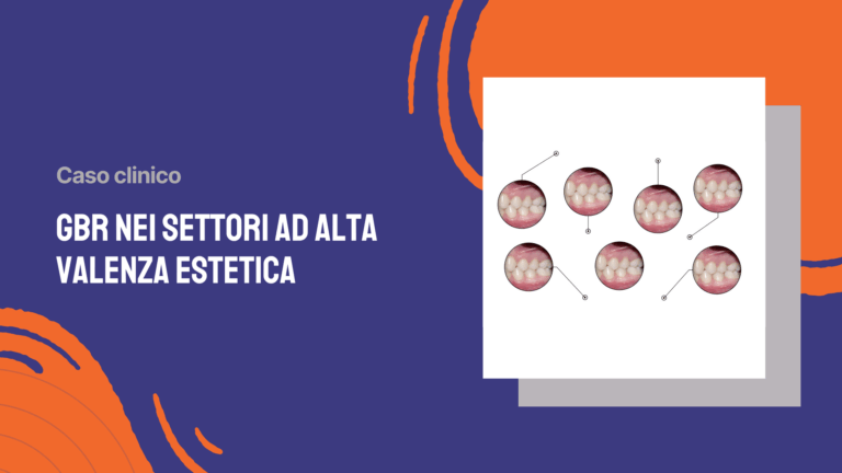 GBR nei settori ad alta valenza estetica