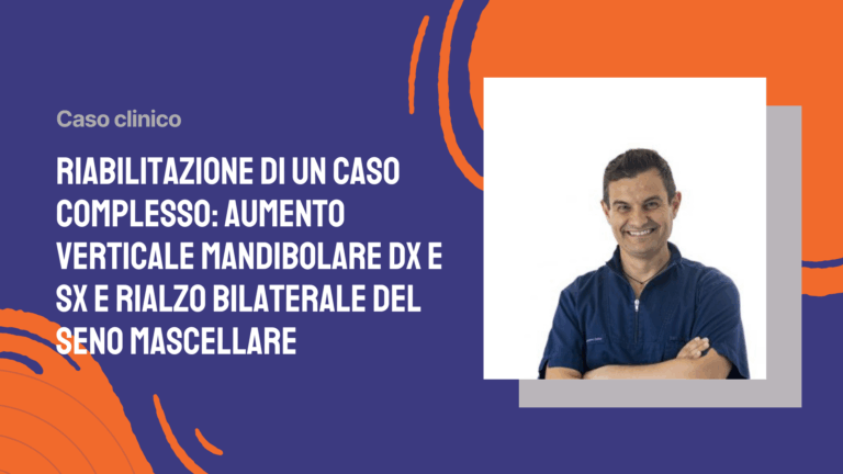 Riabilitazione di un caso complesso: aumento verticale mandibolare dx e sx e rialzo bilaterale del seno mascellare