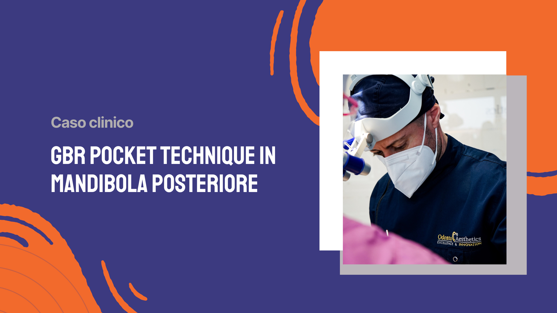 GBR Pocket Technique in mandibola posteriore