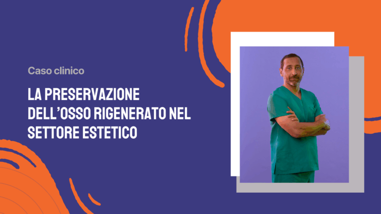 La preservazione dell’osso rigenerato nel settore estetico