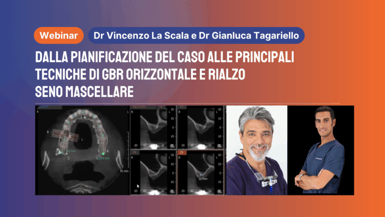Dalla pianificazione del caso alle principali tecniche di GBR orizzontale e rialzo seno mascellare