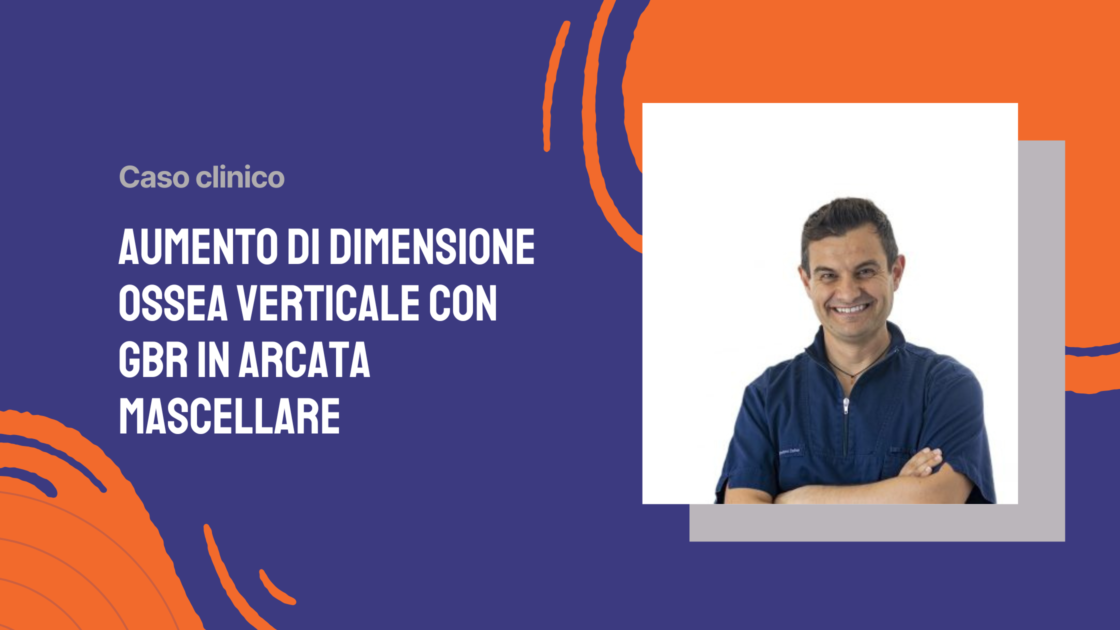 AUMENTO DI DIMENSIONE OSSEA VERTICALE CON GBR IN ARCATA MASCELLARE