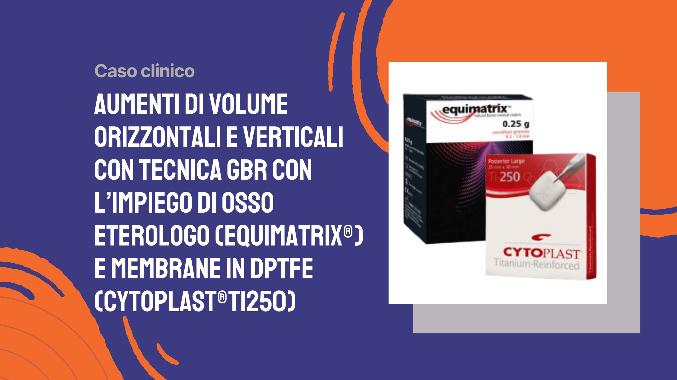 Aumenti di volume orizzontali e verticali con tecnica GBR con l’impiego di osso eterologo (Equimatrix®) e membrane in dPTFE (Cytoplast®Ti250)