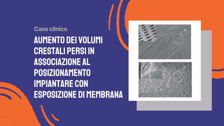 Aumento dei volumi crestali persi in associazione al posizionamento impiantare con esposizione di membrana