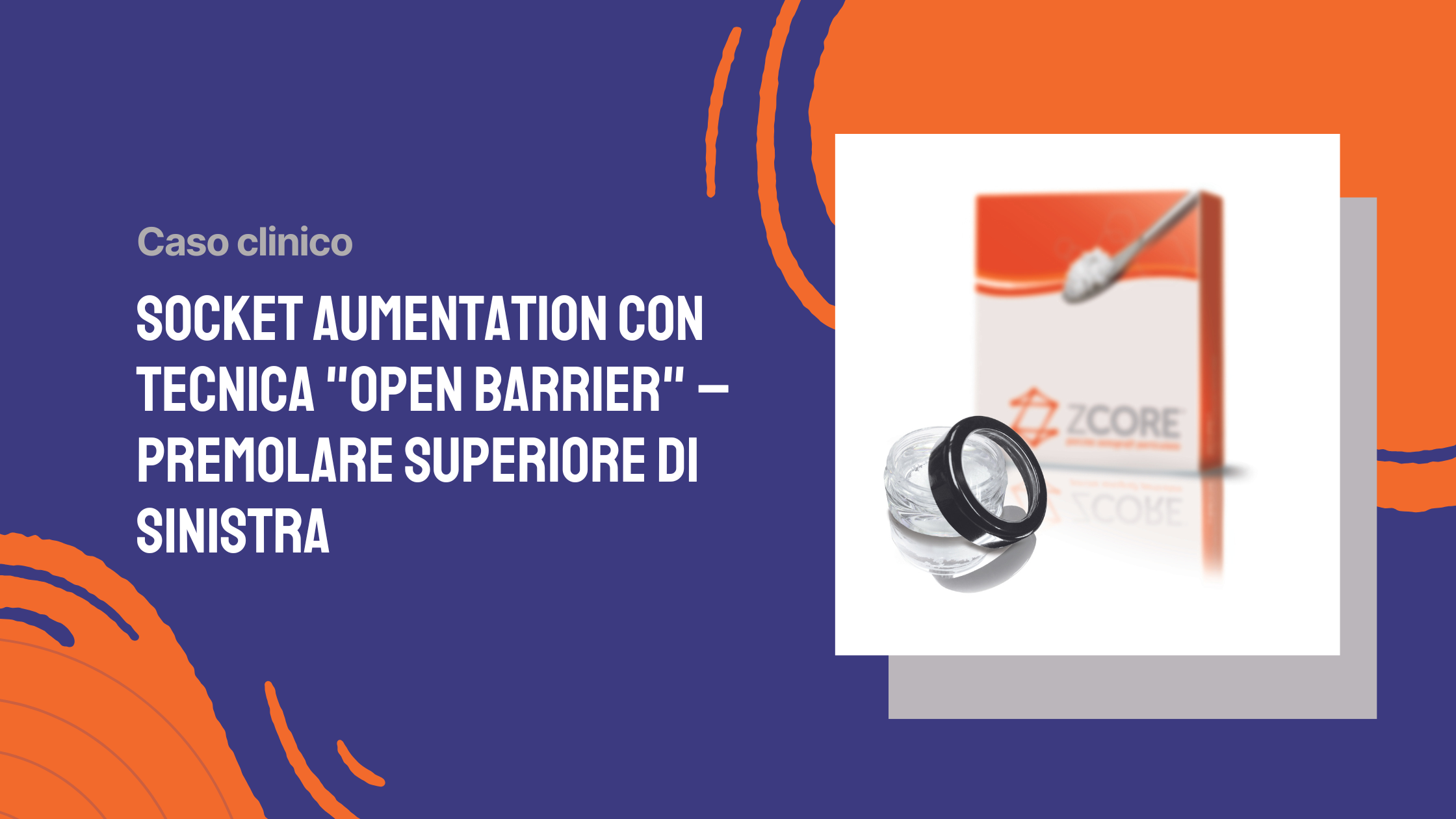 SOCKET AUMENTATION CON TECNICA “OPEN BARRIER” – Premolare superiore di sinistra