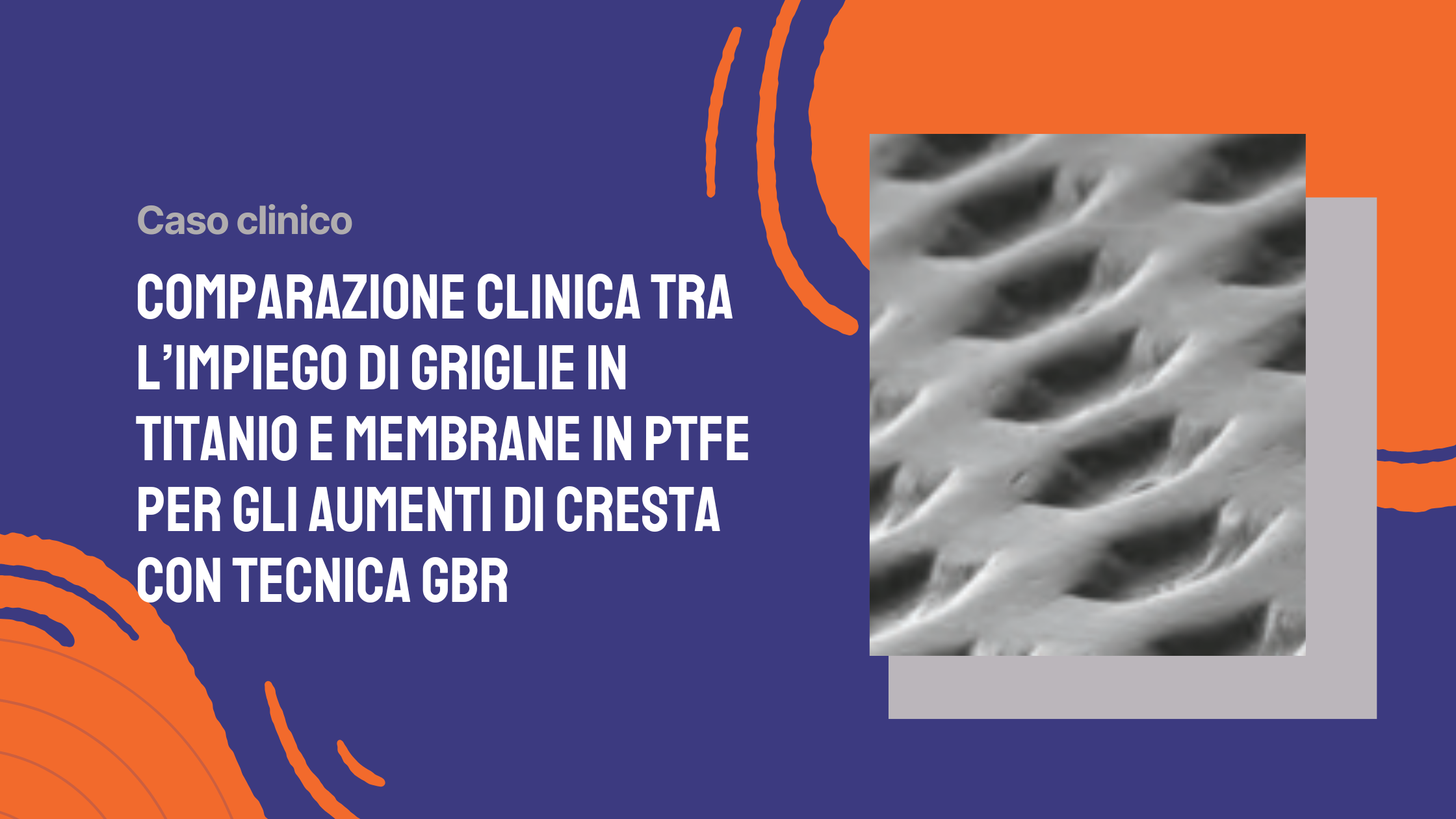 Comparazione clinica tra l’impiego di griglie in titanio e membrane in PTFE per gli aumenti di cresta con tecnica GBR