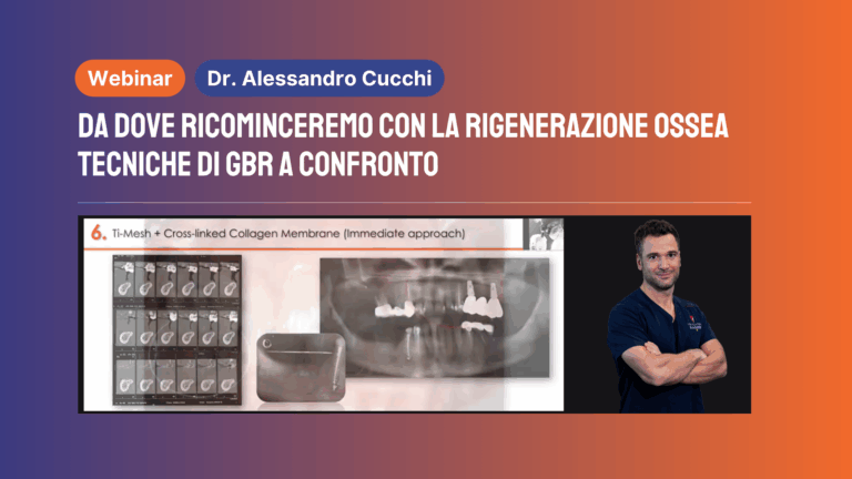Da dove ricominceremo con la rigenerazione ossea Tecniche di GBR a confronto