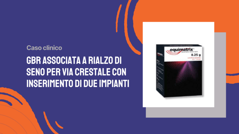 GBR associata a rialzo di seno per via crestale con inserimento di due impianti