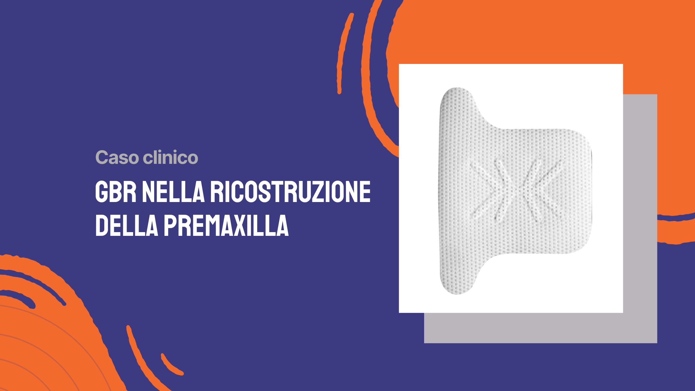 GBR nella ricostruzione della premaxilla