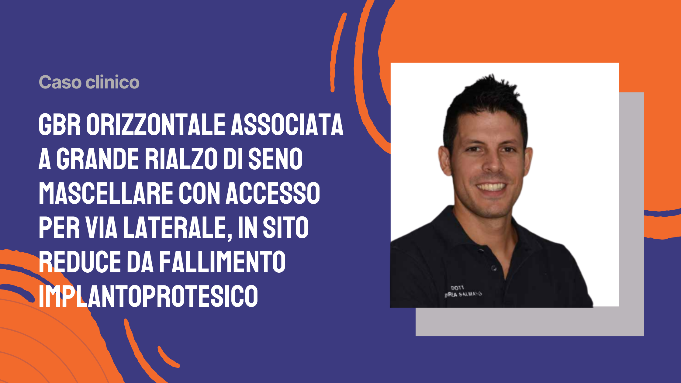 GBR orizzontale associata a grande rialzo di seno mascellare con accesso per via laterale, in sito reduce da fallimento implantoprotesico