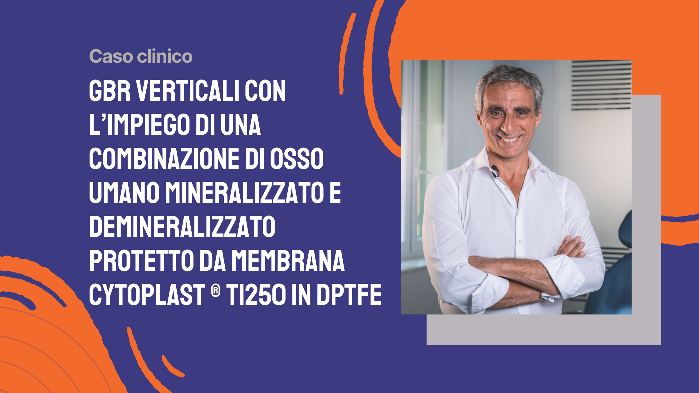 GBR verticali con l’impiego di una combinazione di osso umano mineralizzato e demineralizzato(enCore® Combination Allograft) protetto da membrana Cytoplast ® Ti250 in dPTFE