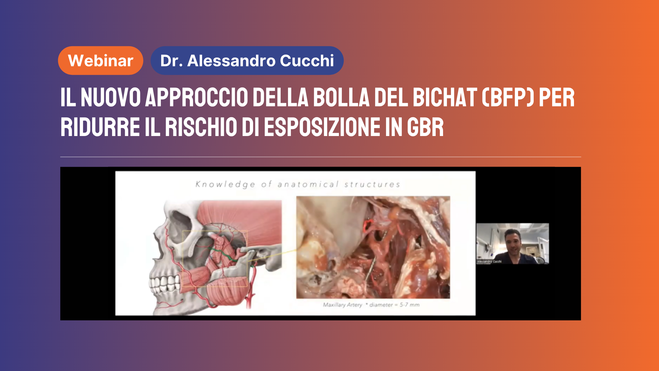 Il nuovo approccio della bolla del Bichat (BFP) per ridurre il rischio di esposizione in GBR