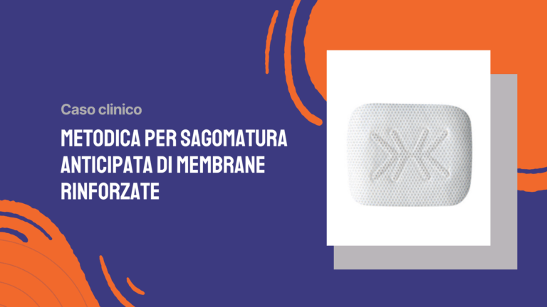 Metodica per sagomatura anticipata di membrane rinforzate