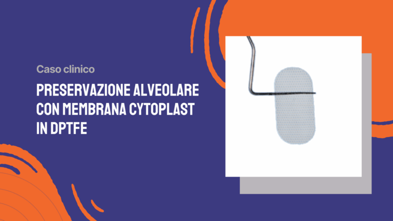 Preservazione alveolare con membrana Cytoplast in dPTFE