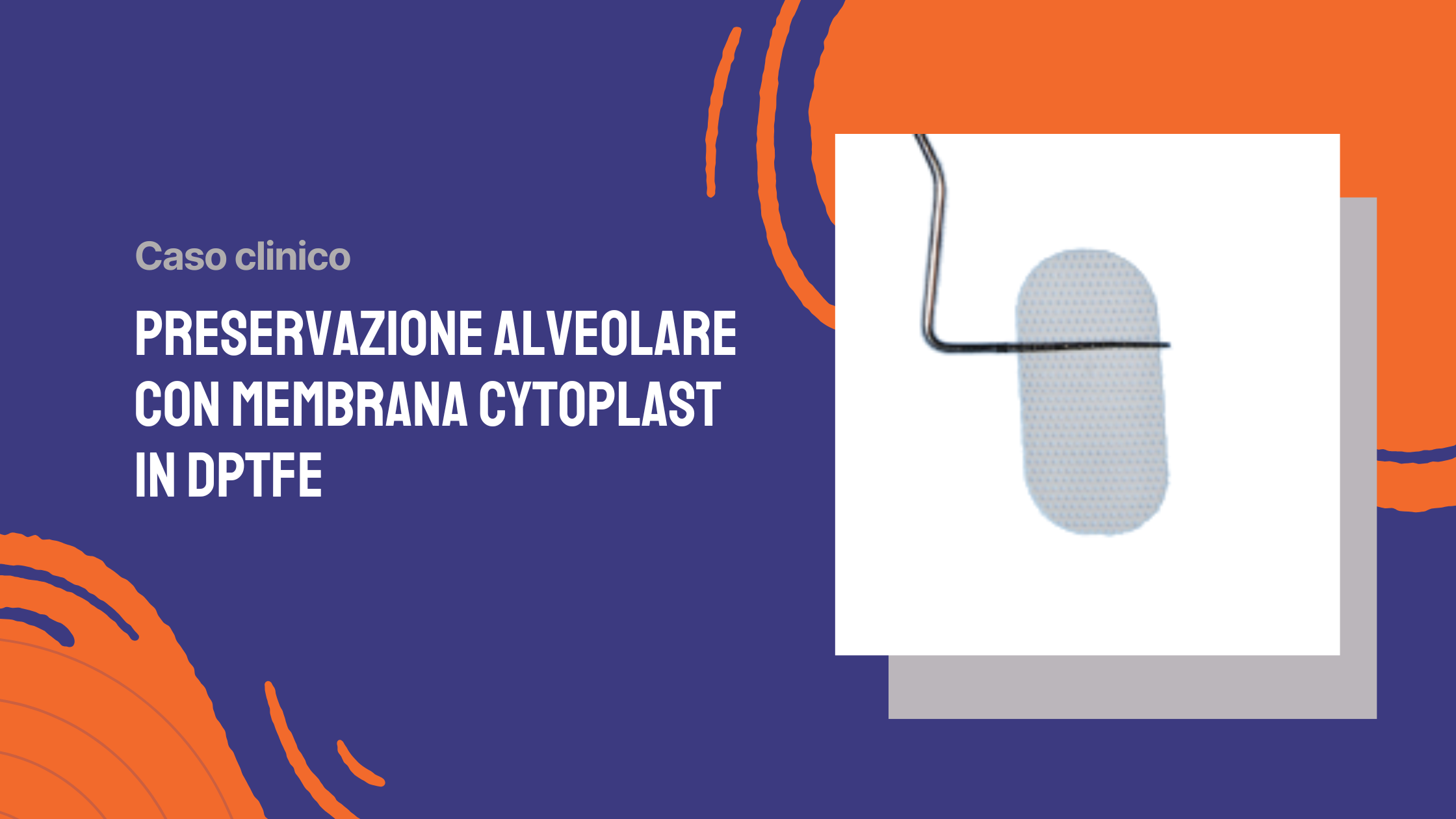 Preservazione alveolare con membrana Cytoplast in dPTFE