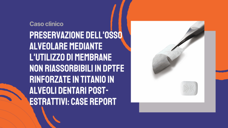 Preservazione dell’osso alveolare mediante l’utilizzo di membrane non riassorbibili in dPTFE rinforzate in titanio in alveoli dentari post-estrattivi: case report