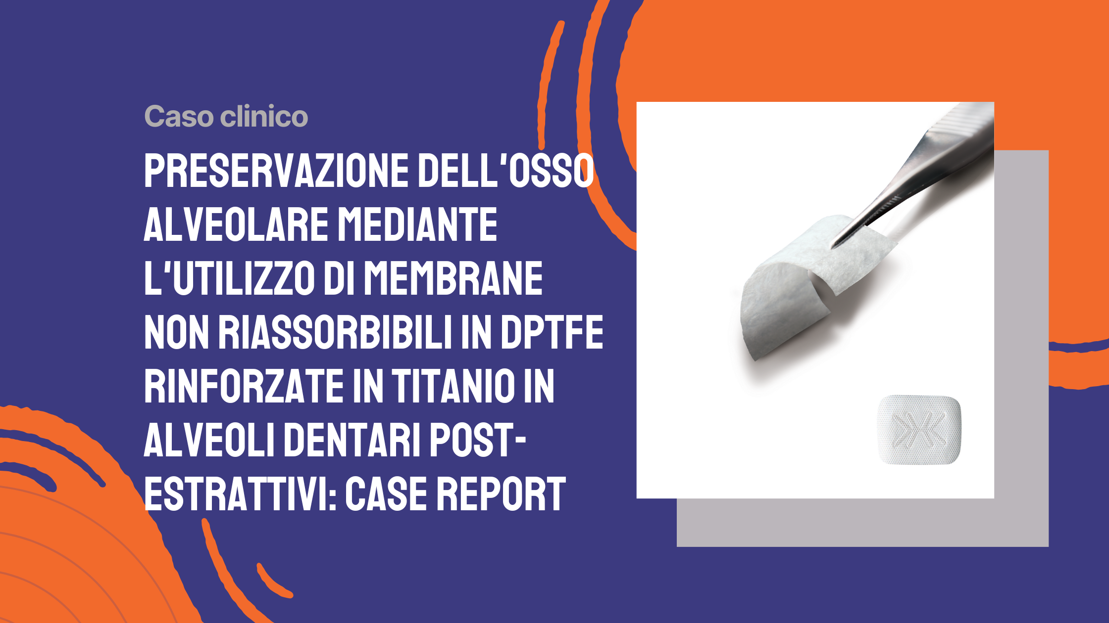 Preservazione dell'osso alveolare mediante l'utilizzo di membrane non riassorbibili in dPTFE rinforzate in titanio in alveoli dentari post-estrattivi case report