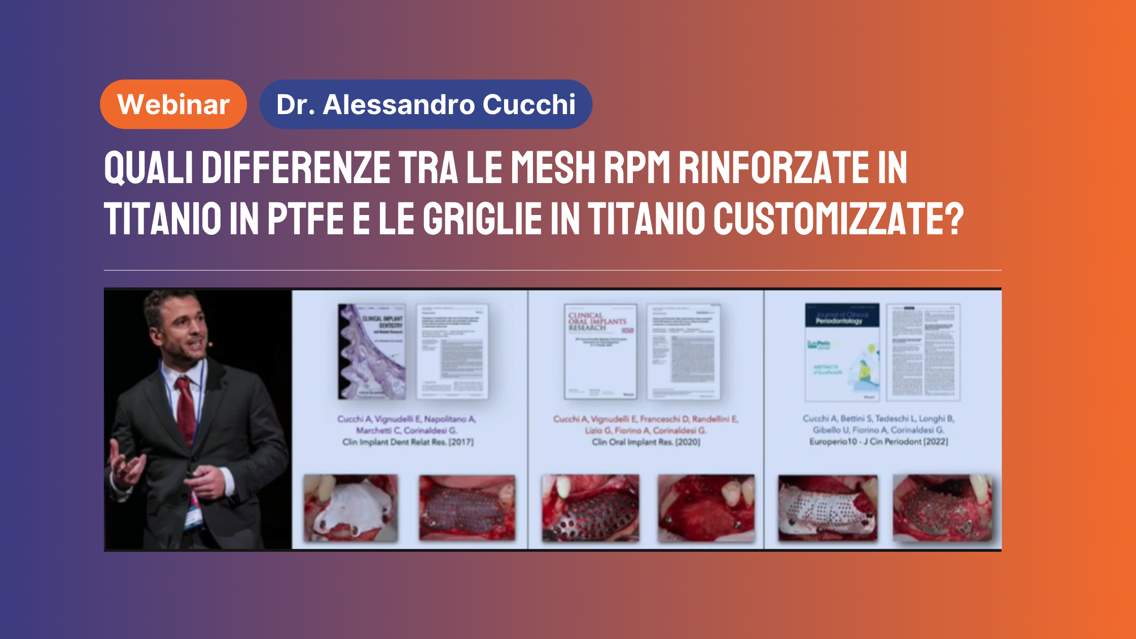 Quali differenze tra le mesh RPM rinforzate in titanio in PTFE e le griglie in titanio customizzate
