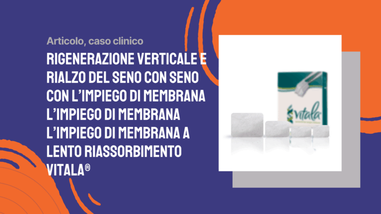 Rigenerazione verticale e rialzo del seno con l’impiego di membrana a lento riassorbimento Vitala®