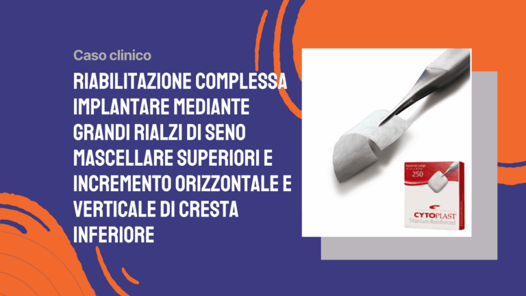 Riabilitazione complessa implantare mediante grandi rialzi di seno mascellare superiori e incremento orizzontale e verticale di cresta inferiore