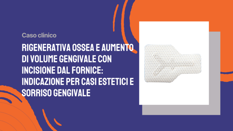 Rigenerativa ossea e aumento di volume gengivale con incisione dal fornice: indicazione per casi estetici e sorriso gengivale