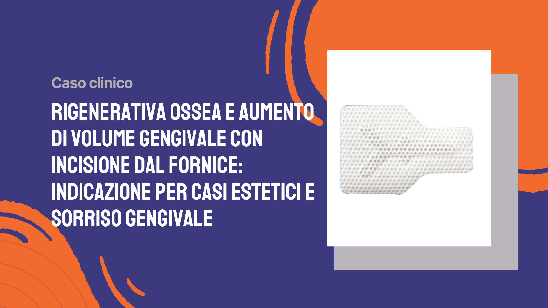 Rigenerativa ossea e aumento di volume gengivale con incisione dal fornice indicazione per casi estetici e sorriso gengivale