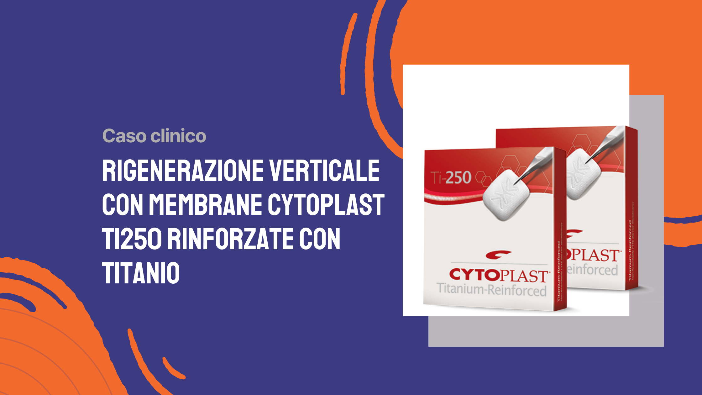 Rigenerazione verticale con membrane Cytoplast Ti250 rinforzate con titanio