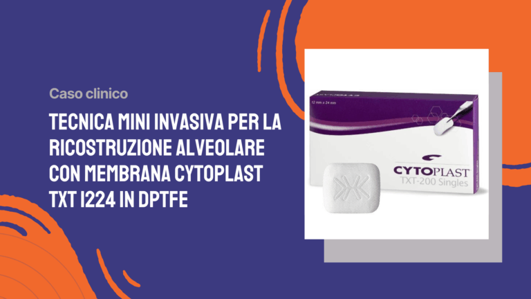 Tecnica mini invasiva per la ricostruzione alveolare con membrana Cytoplast TXT 1224 in dPTFE