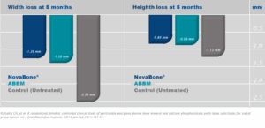 novabone-socket-preservation