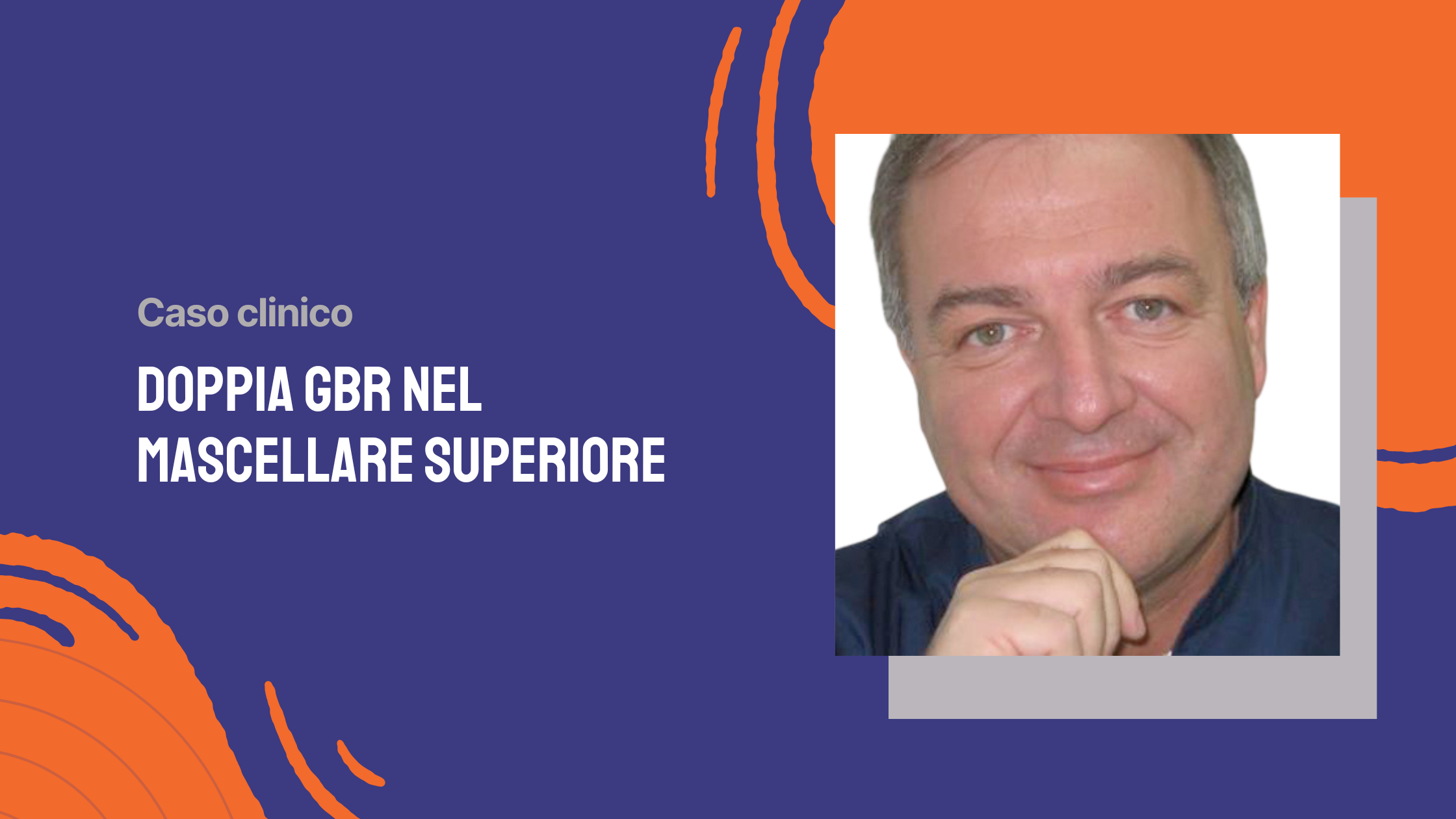 Doppia GBR nel mascellare superiore