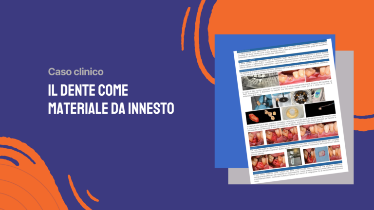 Il dente come materiale da innesto