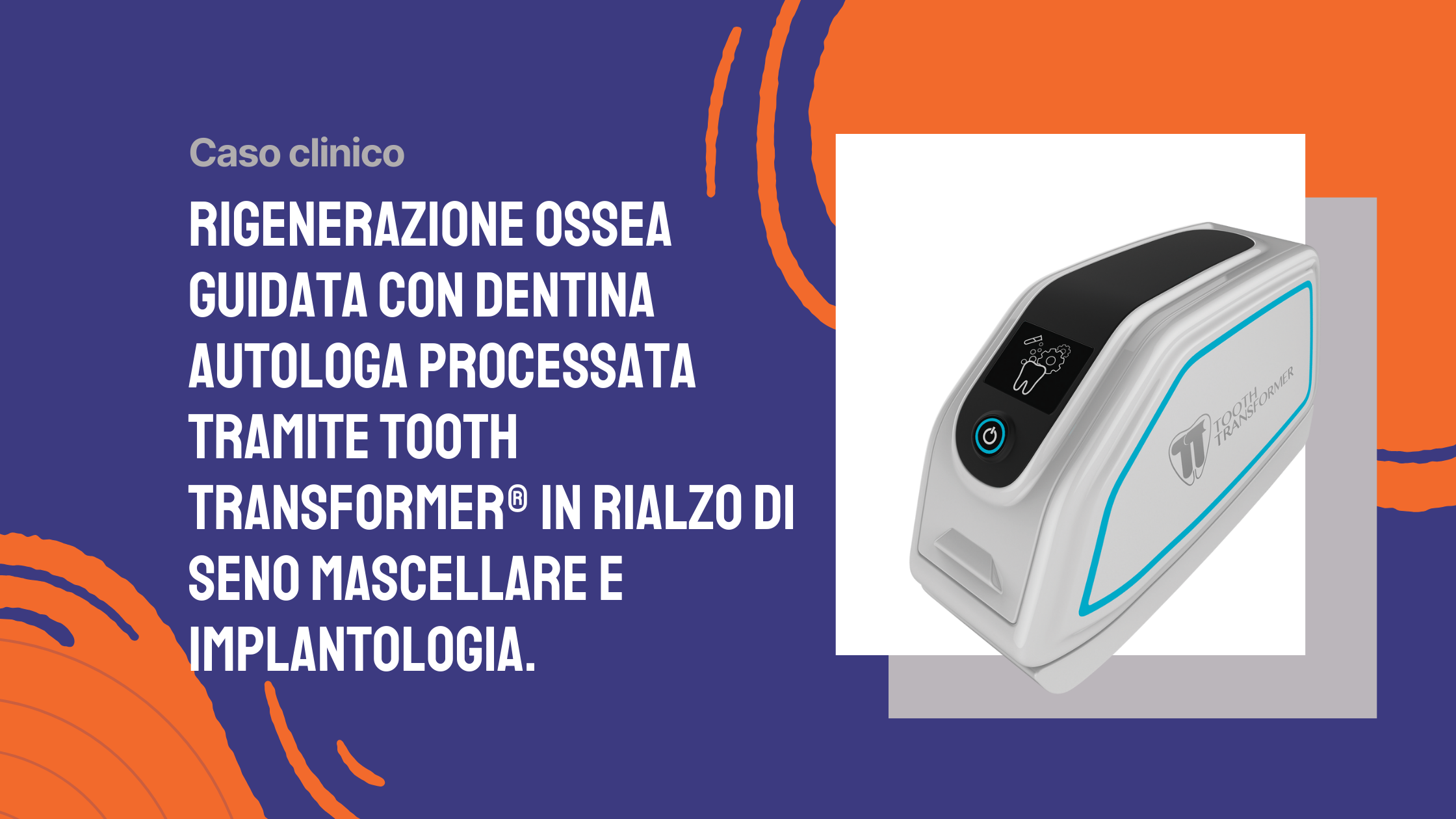 Rigenerazione ossea guidata con dentina autologa processata tramite Tooth Transformer in rialzo di seno mascellare e implantologia.