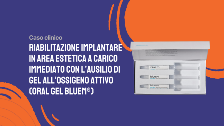 Riabilitazione implantare in area estetica a carico immediato con l’ausilio di gel all’ossigeno attivo (Oral Gel Bluem®)